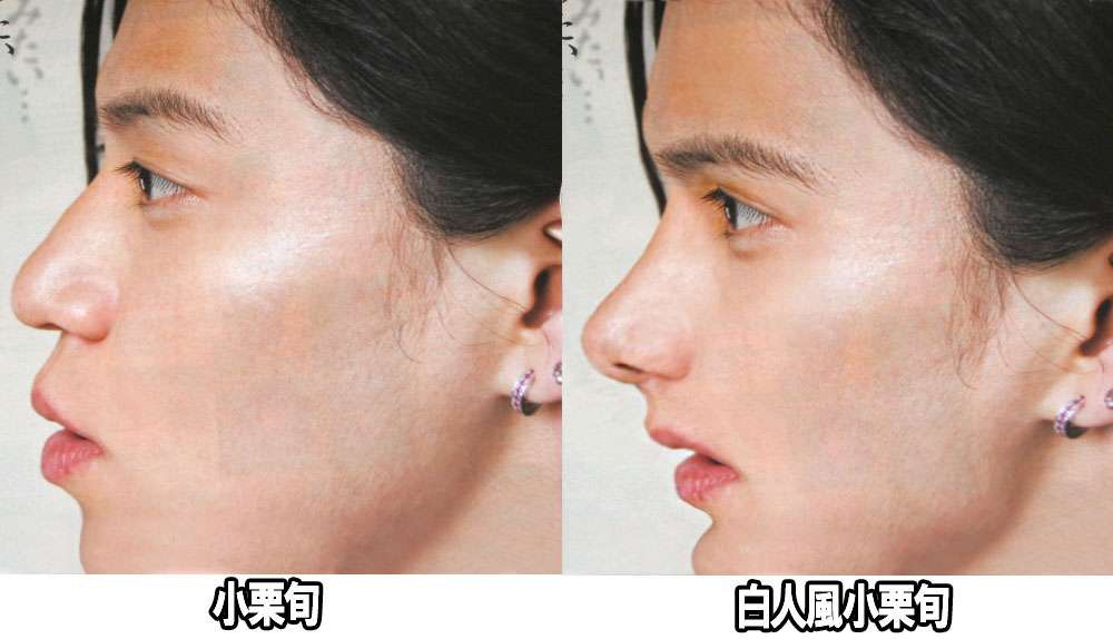 横顔ブスの人