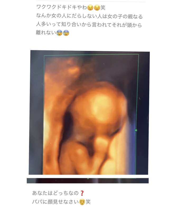 才賀紀左衛門の恋人がブログ新設 妊娠6カ月「パートナーのえり」と自己紹介 ラブラブ写真も