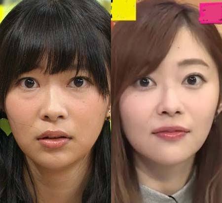クマ取り手術した事ある人