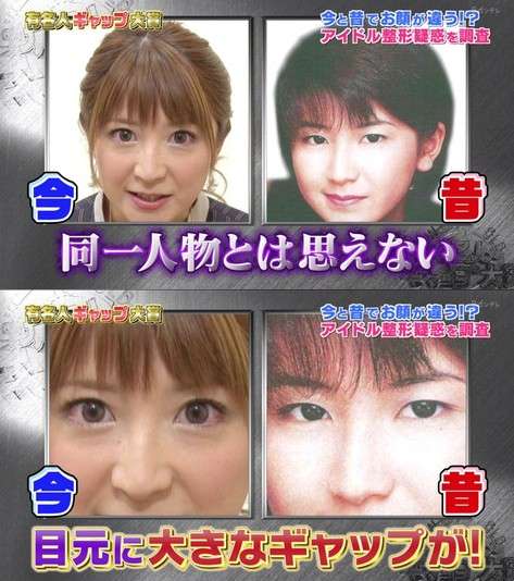 【緊急】二重が奥ぶたえになるようになった