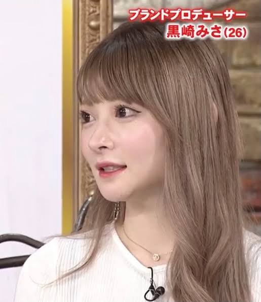 【閲覧注意】総費用1千万超「整形アイドル」轟ちゃん、壮絶な「ダウンタイム」報告 目周り黄色く腫れ...「痛すぎて嘔吐した」