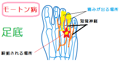 今の病気を伝えると、アドバイスくれるトピ。