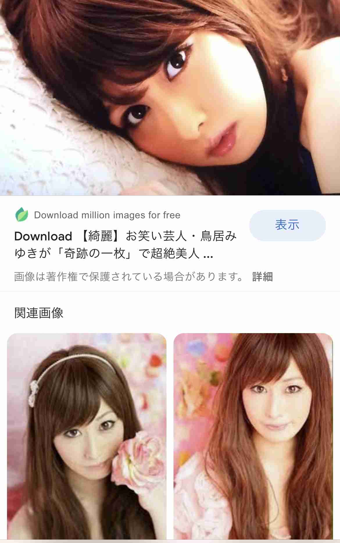鳥居みゆき 発達障がいのテーマに「ほとんどの内容が自分に当てはまった」
