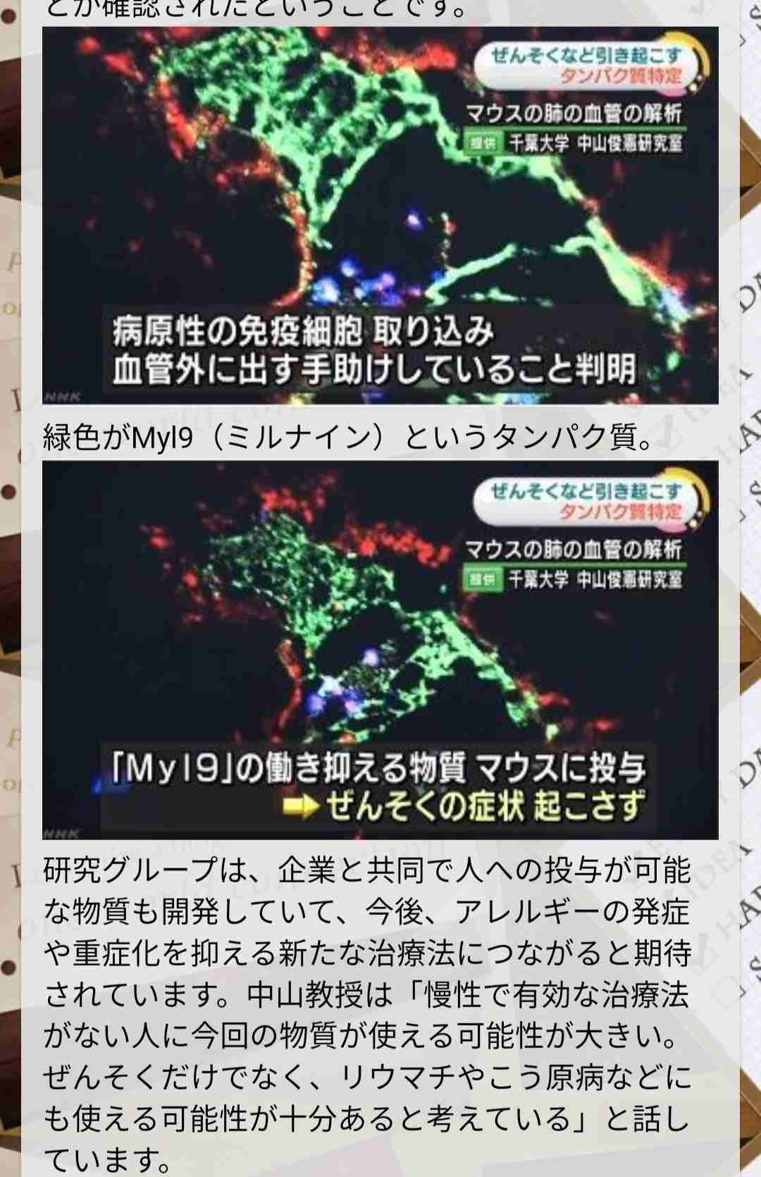 コロナ重症化の仕組み解明　千葉大病院　タンパク質の濃度上昇　入院判断や治療薬開発に期待