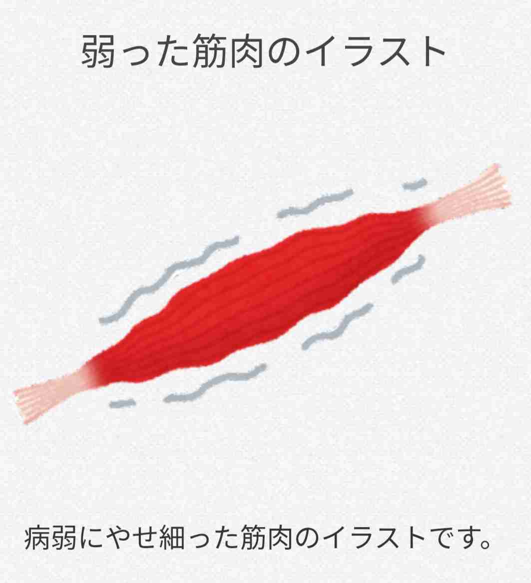 筋肉痛