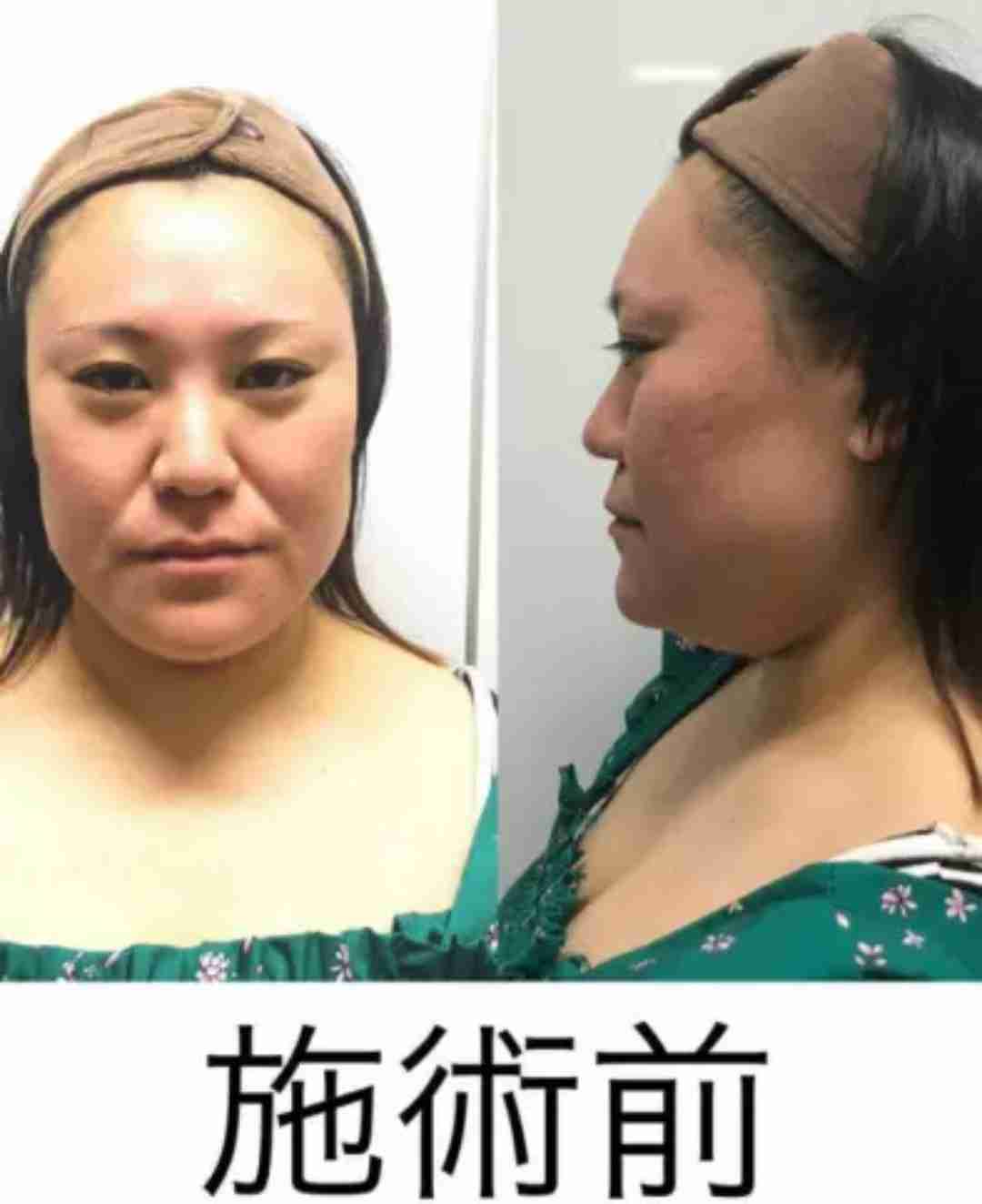 美肌かつ美髪な人、身近でどれくらいいる？