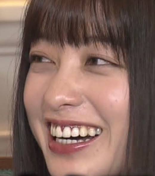 歯列矯正して良かったと思う人！