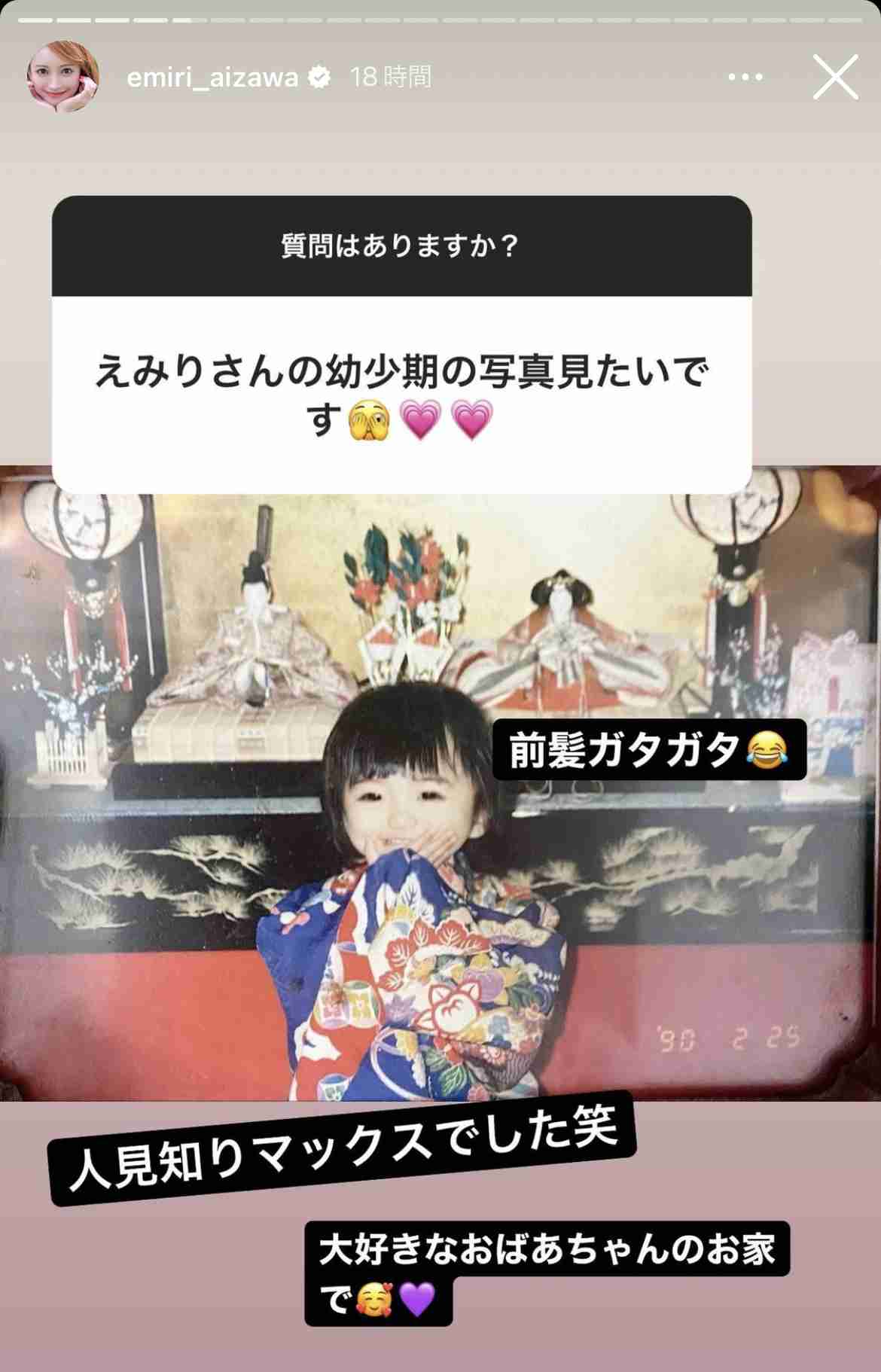 元キャバ嬢社長でモデルの愛沢えみり、33歳最新ショット＆整形総額費用を告白「目、鼻、歯…」