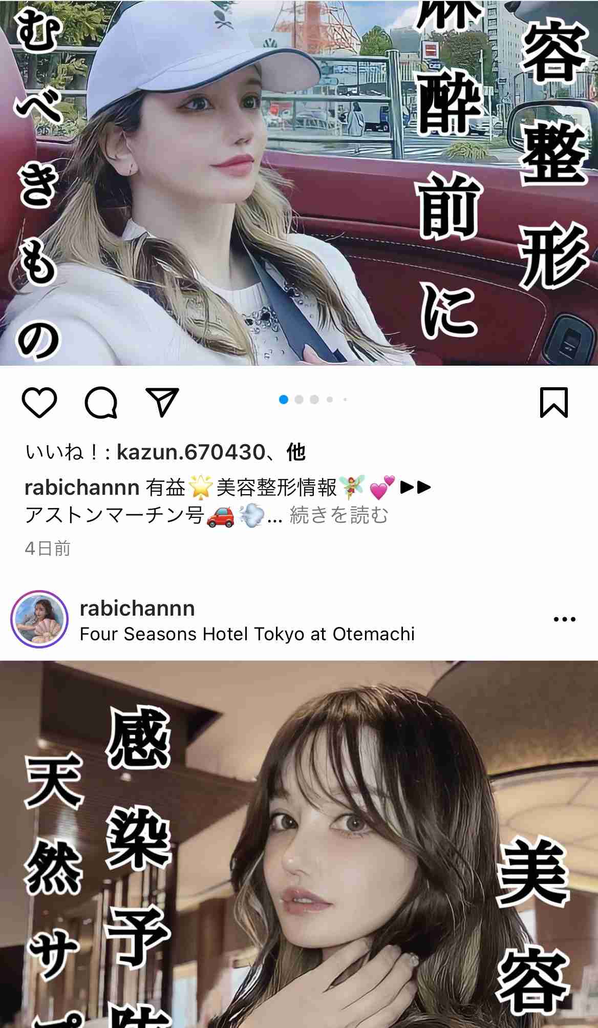 “離れ目の童顔になりたい”眼球の位置を変えようとした女性 “フル整形4周目”突入も「もうこれ以上はできないのがつらい」