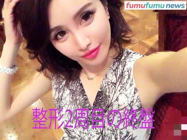 “離れ目の童顔になりたい”眼球の位置を変えようとした女性 “フル整形4周目”突入も「もうこれ以上はできないのがつらい」