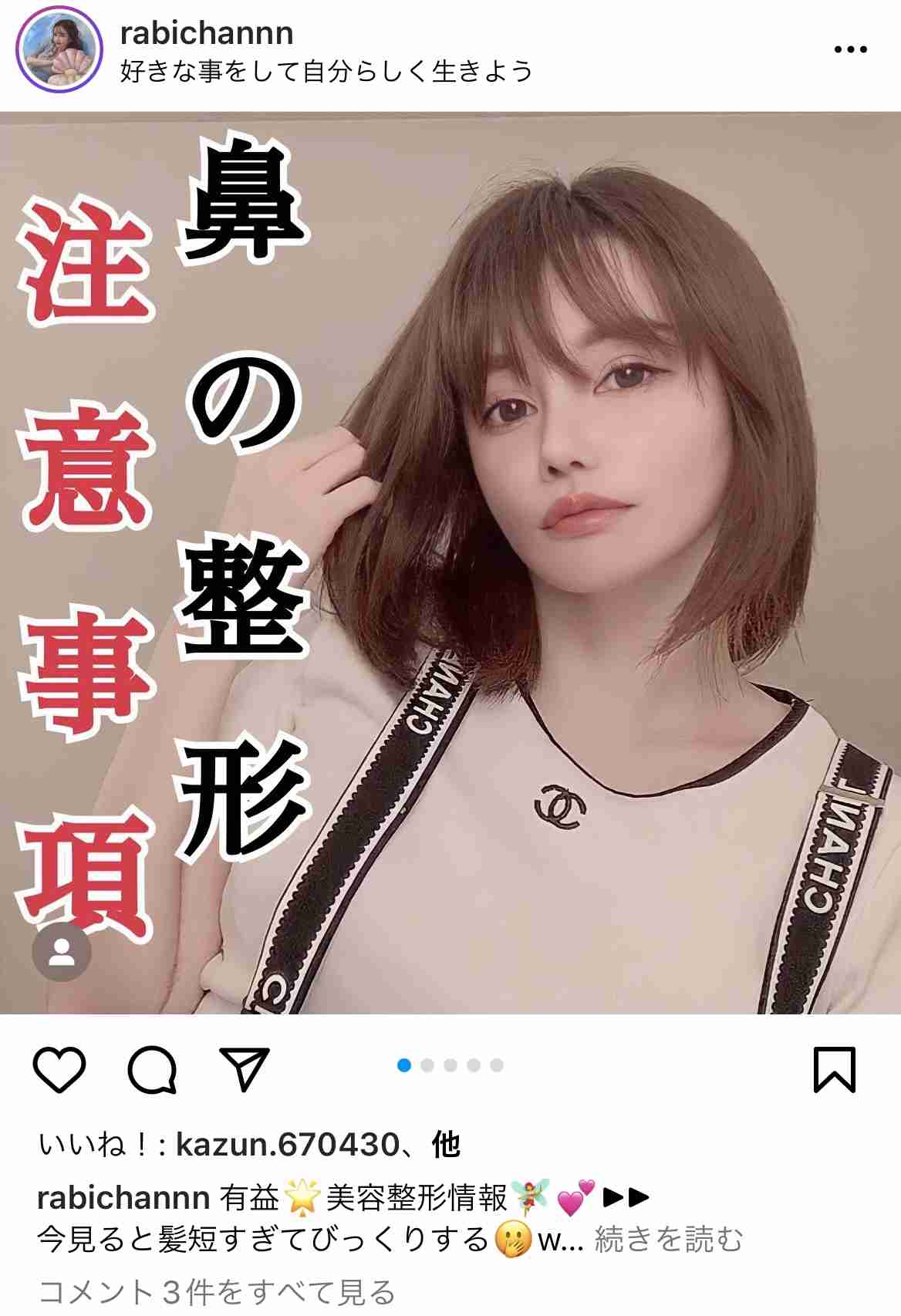 “離れ目の童顔になりたい”眼球の位置を変えようとした女性 “フル整形4周目”突入も「もうこれ以上はできないのがつらい」