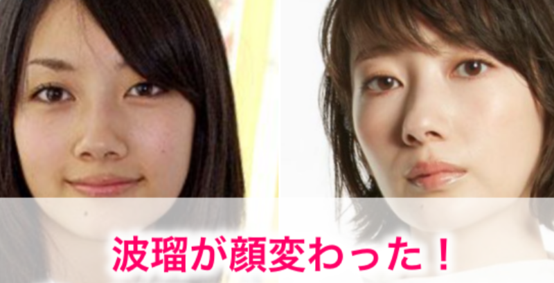 “離れ目の童顔になりたい”眼球の位置を変えようとした女性 “フル整形4周目”突入も「もうこれ以上はできないのがつらい」