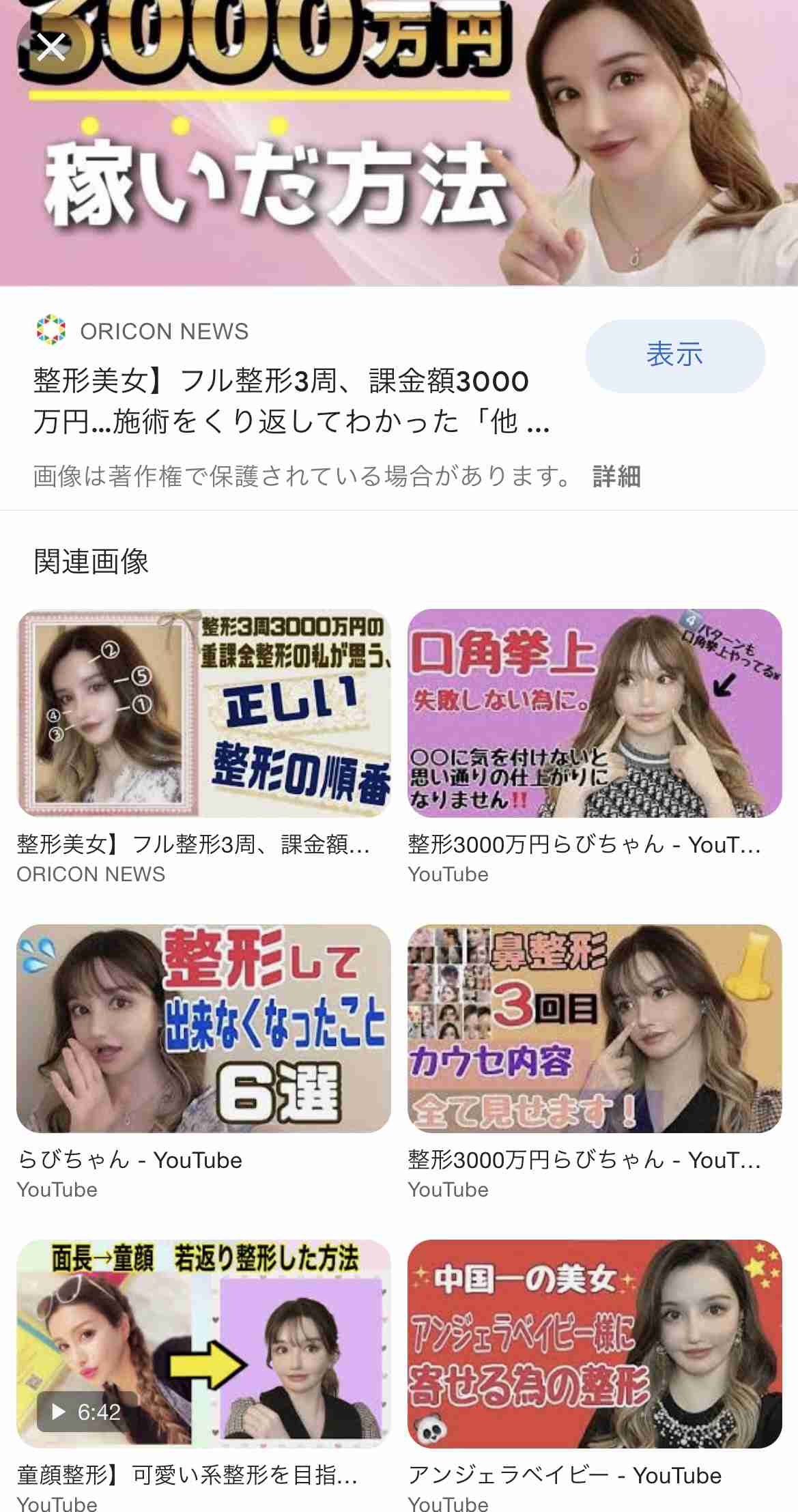 “離れ目の童顔になりたい”眼球の位置を変えようとした女性 “フル整形4周目”突入も「もうこれ以上はできないのがつらい」