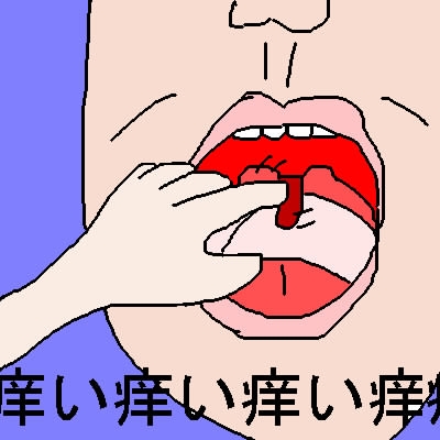 この時期、喉がかゆい人
