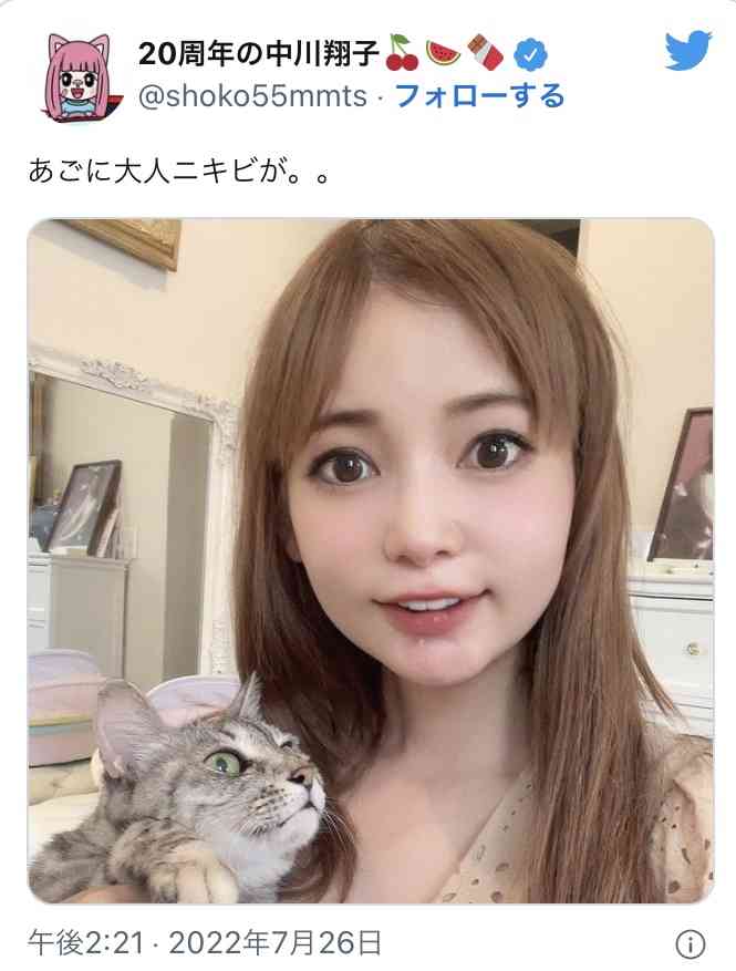 中川翔子が“真っ白の歯”披露「やっと笑えるかもしれない」