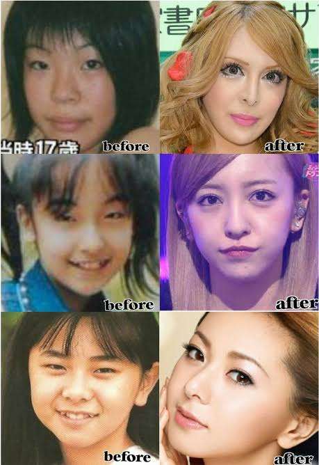 整形してモテるようになった女友達が許せない…「偽りの顔なのに!」