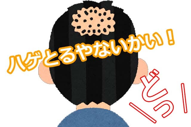 推しが禿げてきた