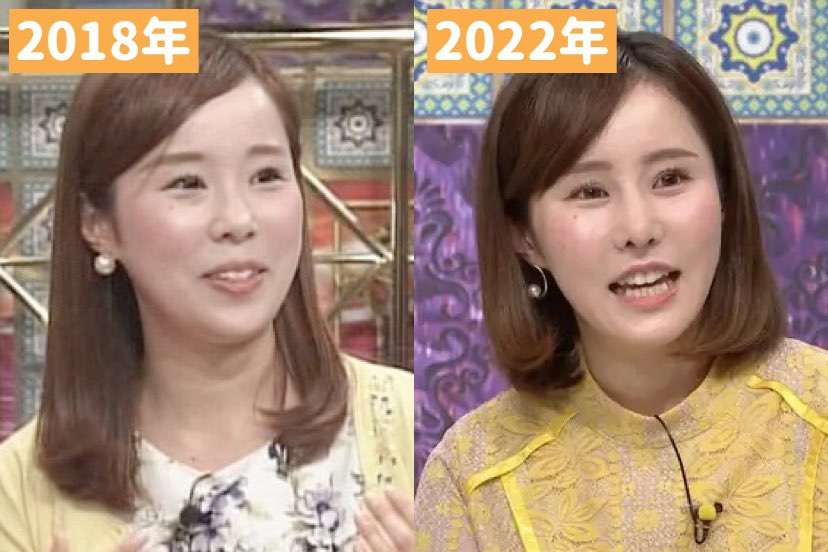 イメチェン前後の画像を貼るトピPart2