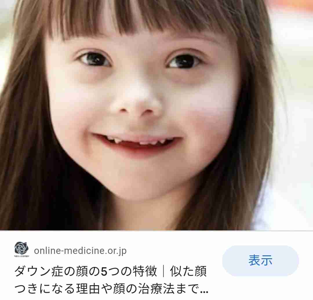 「俺は一体何やってるんだ」ダウン症の子を産む…決断した家族の思い