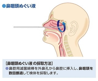 コロナ後遺症Part2