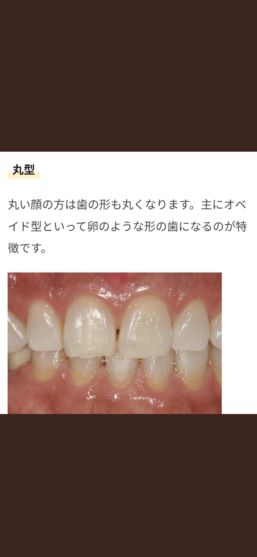 藤田ニコル　短い前歯の“仮歯の仮歯”姿披露に「自然！」「より大人っぽい」の声