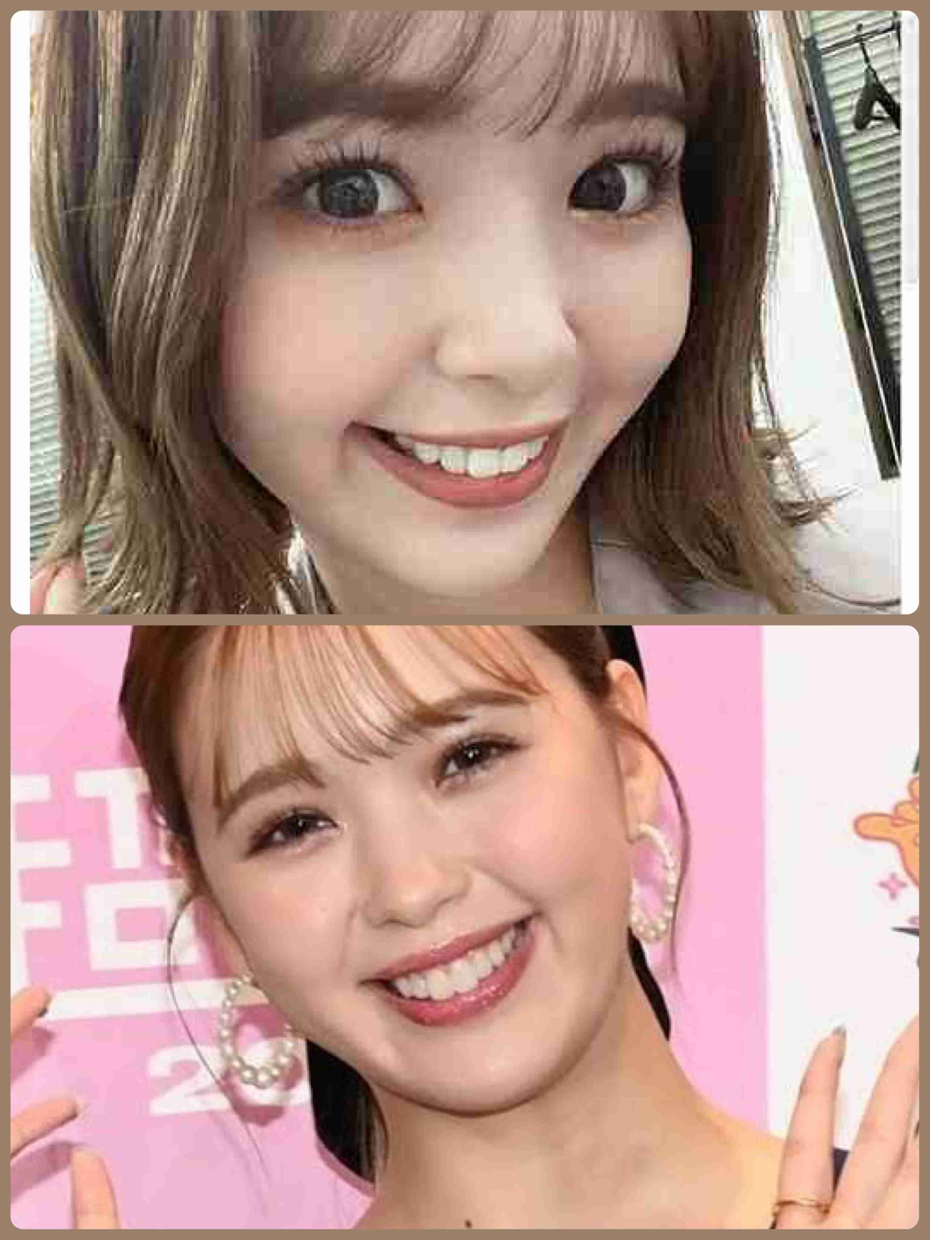 藤田ニコル　短い前歯の“仮歯の仮歯”姿披露に「自然！」「より大人っぽい」の声