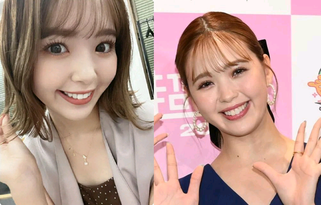 藤田ニコル　短い前歯の“仮歯の仮歯”姿披露に「自然！」「より大人っぽい」の声