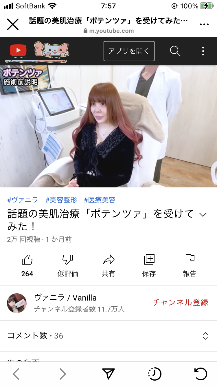 “整形に3億円”話題のヴァニラ、ワンピース私服姿に反響「美しい」「スタイル良い」