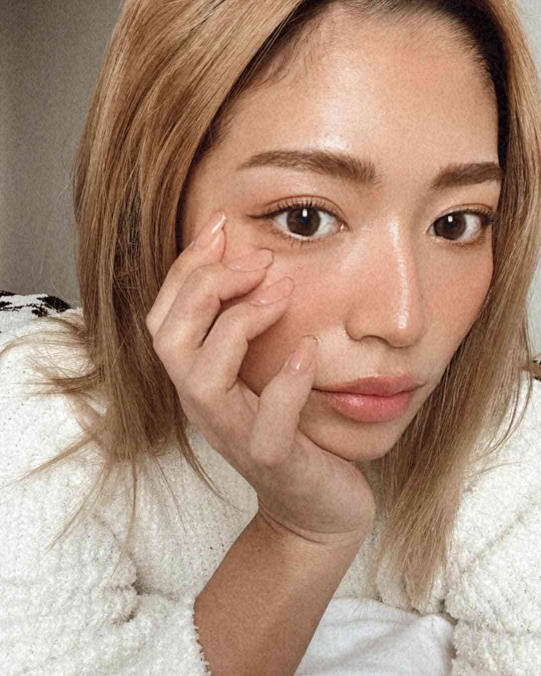元テラハの今井華、唇にヒアルロン酸注入！ぽってりビフォーアフター公開「ナチュラルにボリュームアップ」
