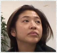 元テラハの今井華、唇にヒアルロン酸注入！ぽってりビフォーアフター公開「ナチュラルにボリュームアップ」