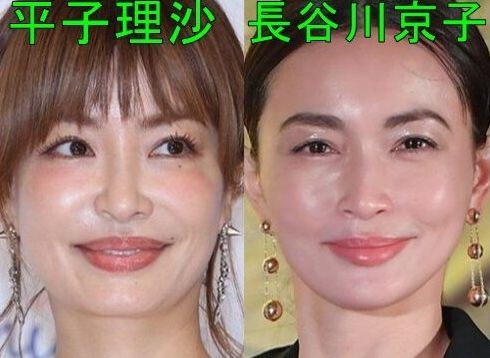 元テラハの今井華、唇にヒアルロン酸注入！ぽってりビフォーアフター公開「ナチュラルにボリュームアップ」