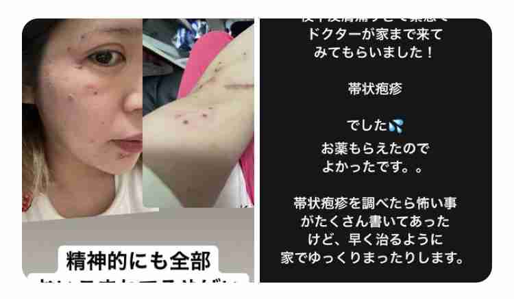 工事現場でクレーンが転倒　通行中の70代女性を搬送