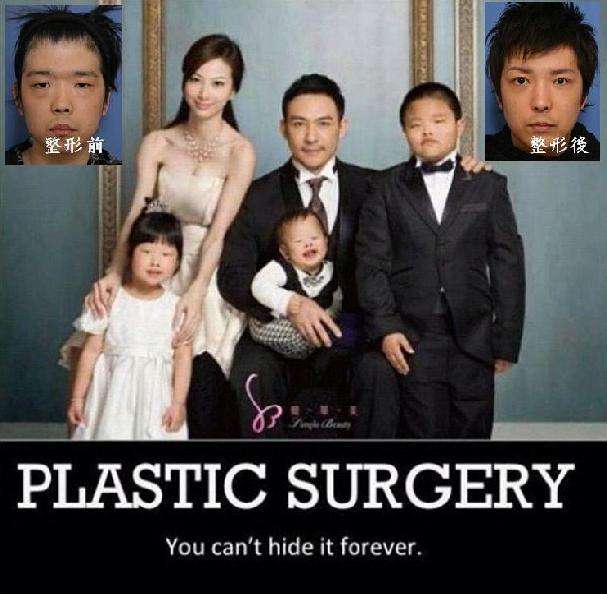 総額420万をかけてコンプレックスを解消　10回の施術から起業した女性「美容整形を努力だという文化を作りたい」