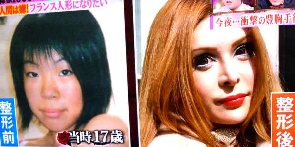 総額420万をかけてコンプレックスを解消　10回の施術から起業した女性「美容整形を努力だという文化を作りたい」