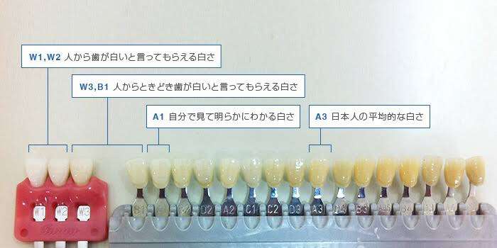 ホームホワイトニングしている人！色々話しませんか？