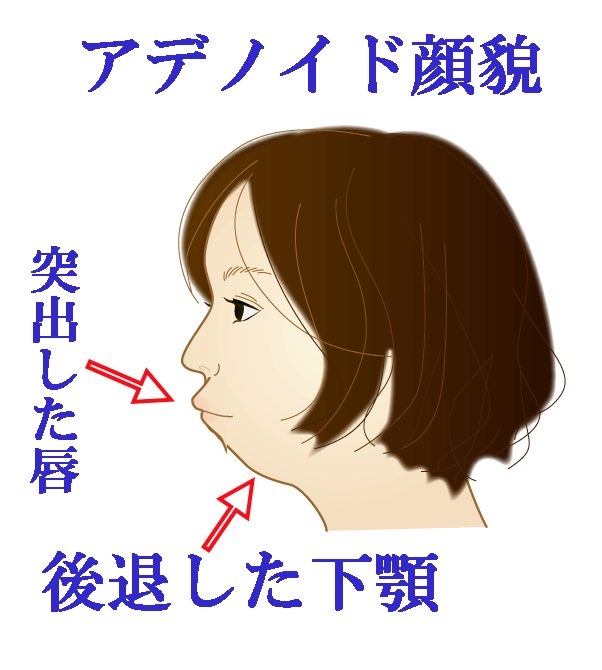 11歳男児が新型コロナワクチン3回目接種後に死亡 熱性けいれんなど既往歴あり