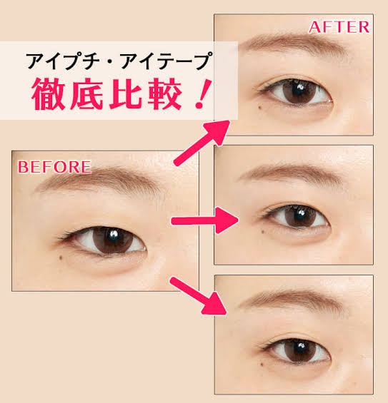 アイテープ、アイプチは恥ずかしい?