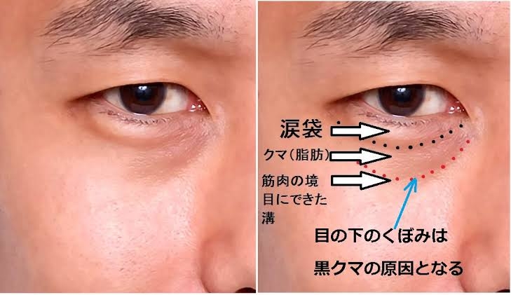 クマを隠すコンシーラーの時間がめっちゃかかる