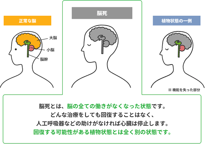 関東で6歳未満女児が脳死　心臓など移植、公表25例目　家族が実施を承諾