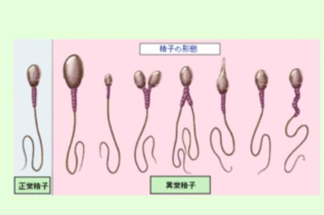 「はやく専業主婦になりたくて」…年収300万の女性が年収1500万の男性と「15歳差婚」をして青ざめたワケ