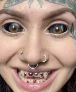 【閲覧注意】過激な身体改造を続ける女性、美しいビフォーの写真に衝撃（米）
