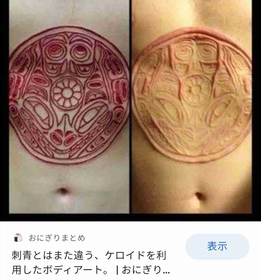 オラオラ系ブームから10年が経ち、当時入れた和彫りのタトゥーを後悔する人たち