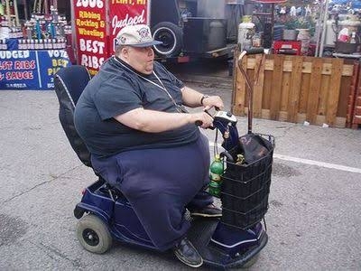 多くのアメリカ人は「太りすぎ」で自分の死体を寄付したくても「要らない」と拒否されてしまう