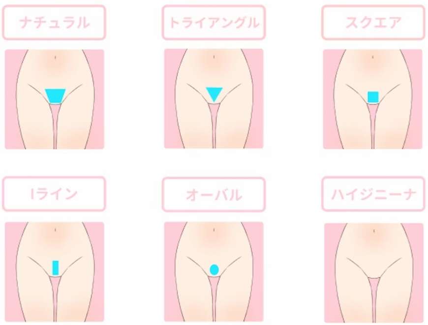 アンダーヘアの処理