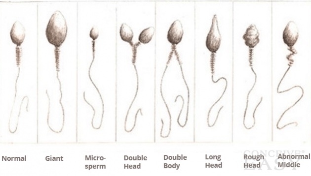 ひろゆき氏“ゆたぼん現象”に危惧「『学校に行かなくていい』と思う頭の悪い子が増えてしまう」