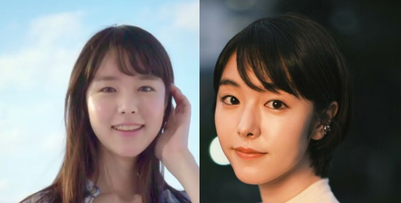 手取り15万円だけど「どうしても美容整形代を出す必要があります」と語る30代女性