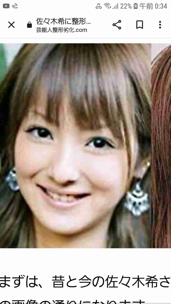佐々木希の「目元」は60万、広瀬すずの「鼻」は200万。予約の取れない美容整形外科医に聞いた、2022年リアル“なりたい”顔BEST５【女性芸能人編】