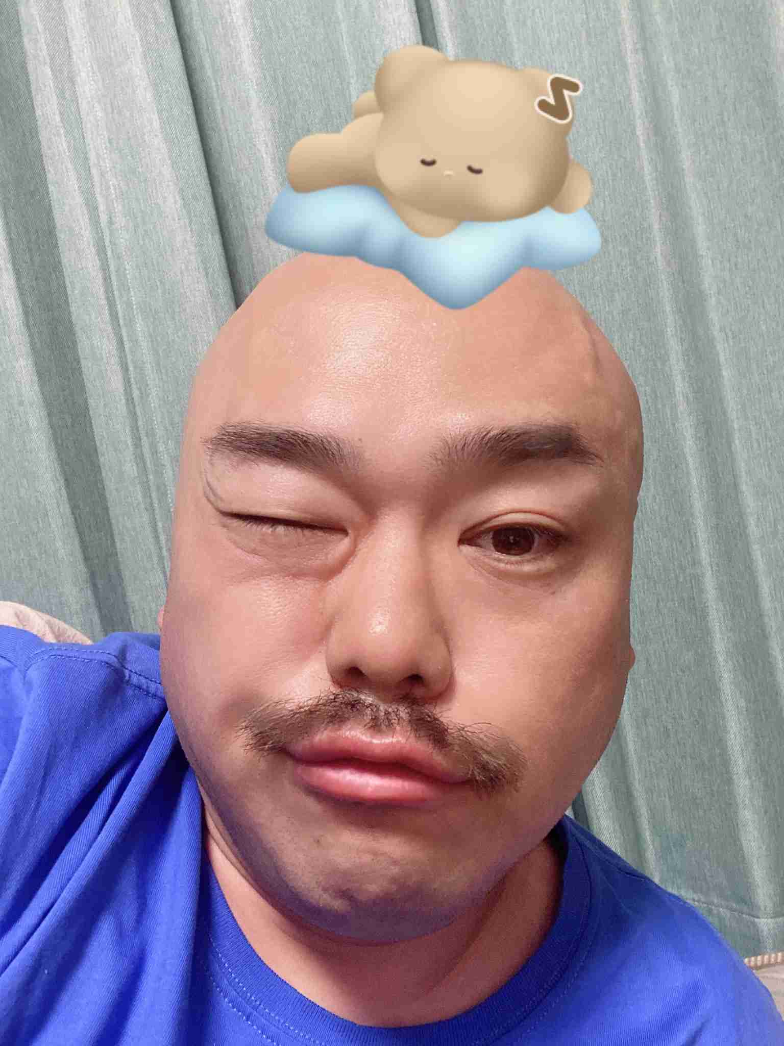 アヒルとアヒル口の画像を交互に貼るトピ　Part3