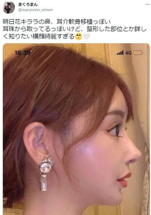 綺麗な横顔が見たい