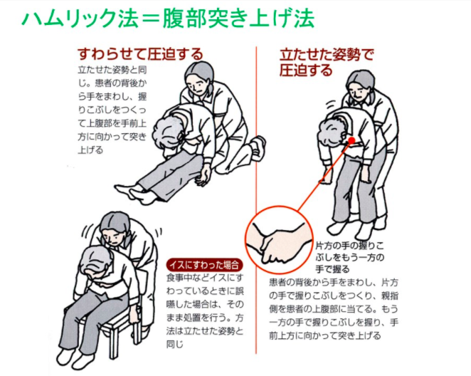 正月に多発する「お餅をのどに詰まらせる」事故　意外にも若い世代が…